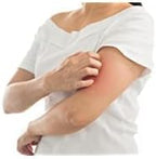 Four tubes of Globe USA imported hydrocortisone for first aid
