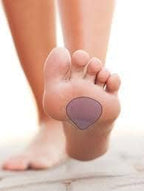 Washable and reusable medical grade gel pads for callus and neuroma relief