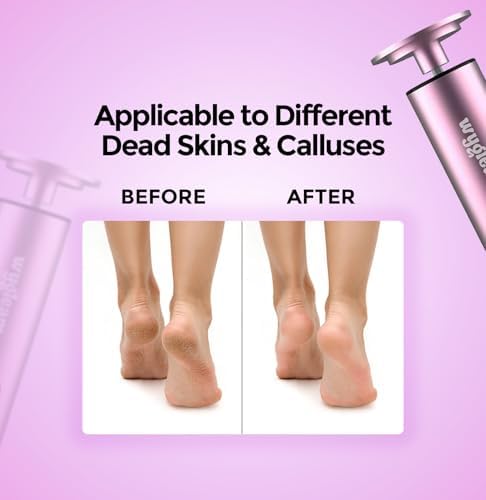 Wygleam portable pedicure tool with USB charging cable and sanding discs.