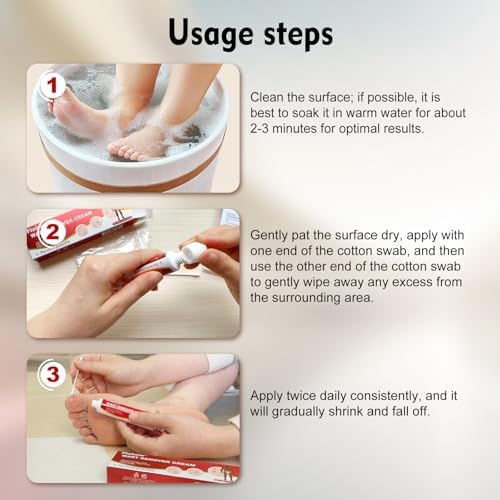 Authentic USA imported OJIOG wart treatment gel for effective home care.