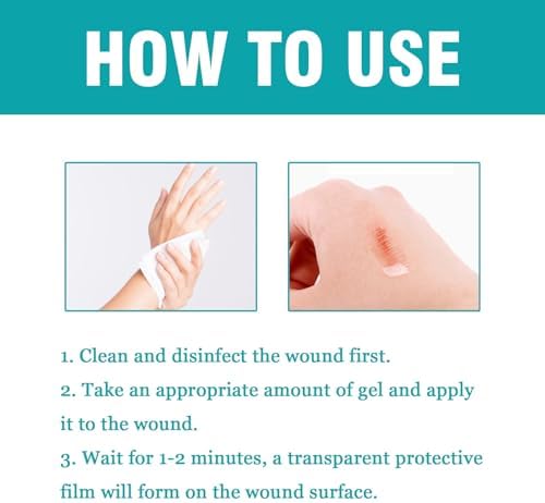 Breathable transparent spray plaster lifestyle view for minor hand blisters.