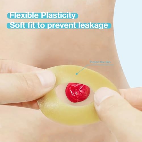 Close-up of the leak-proof stoma barrier ring for colostomy bag protection.