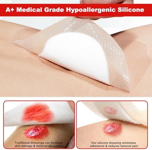 FRESINIDER medical foam bandage showing the flexible design suitable for sacral area protection