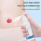 Imported USA ostomy supplies Ovand barrier spray for Indian consumers