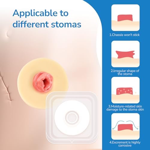 Close up view of the shapeable medical hydrocolloid ring texture