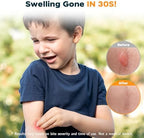 YARKOR insect bite sucker packaging showcasing chemical free relief features