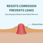 Applying protective ostomy skin barrier paste on uneven peristomal skin contours