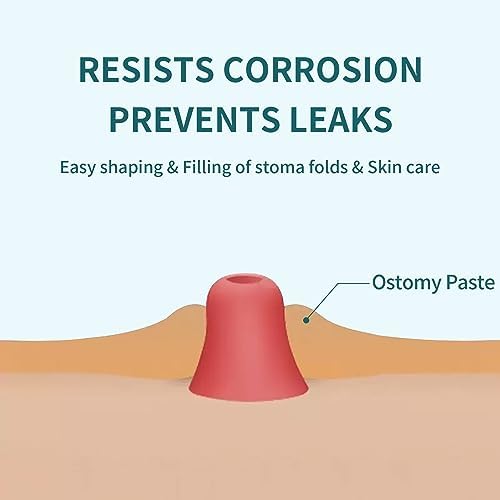 Applying protective ostomy skin barrier paste on uneven peristomal skin contours