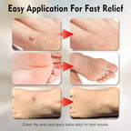 OJIOG wart remover ingredients label highlighting the natural botanical formula.