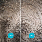 Close up of the 5x magnifying glass on the NitWits head lice tool