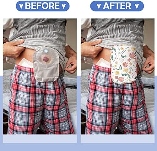 Sosation water resistant shower wraps for ileostomy care and moisture protection