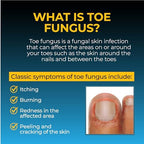 Fungi-Nail bottle with tea tree oil and aloe vera ingredients highlighted