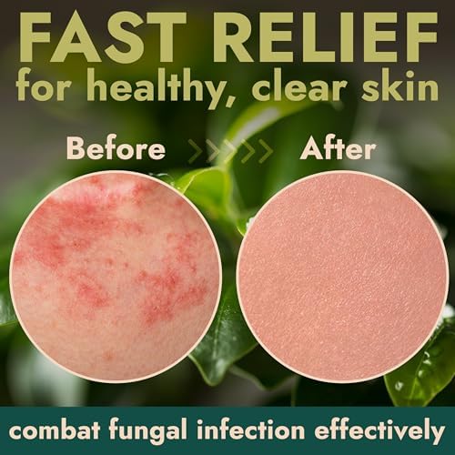 USA imported antifungal spray bottle showing ingredients and directions