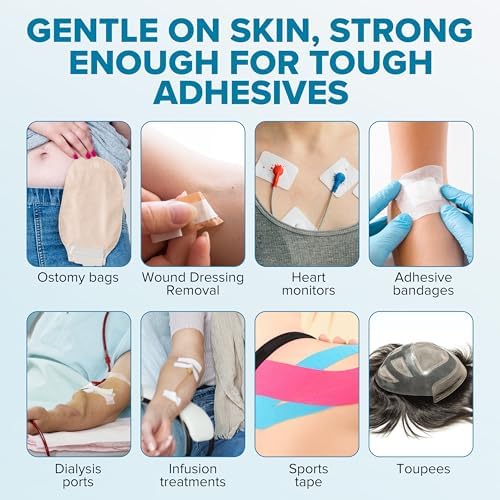EASEntials skin friendly adhesive remover spray showing nozzle and 80ml packaging