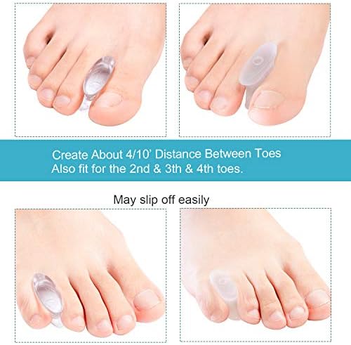 Transparent gel toe separators being worn to show bunion pain relief.
