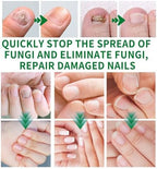 Ginger nail repair liquid providing assistance with 7 day manicure maintenance