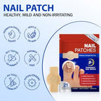 Before and after comparison of fungal nail repair with hydrogel patches