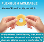 Demonstration of stretching a moldable stoma barrier ring for a custom fit