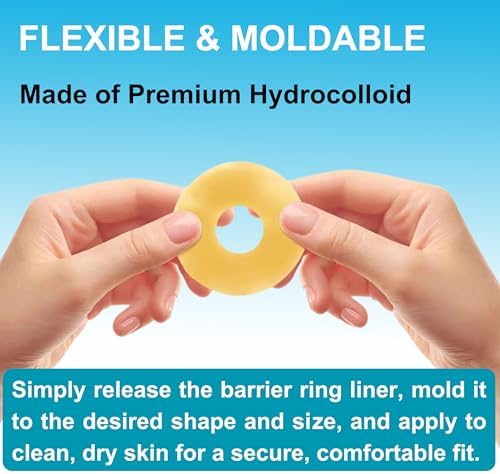 Demonstration of stretching a moldable stoma barrier ring for a custom fit