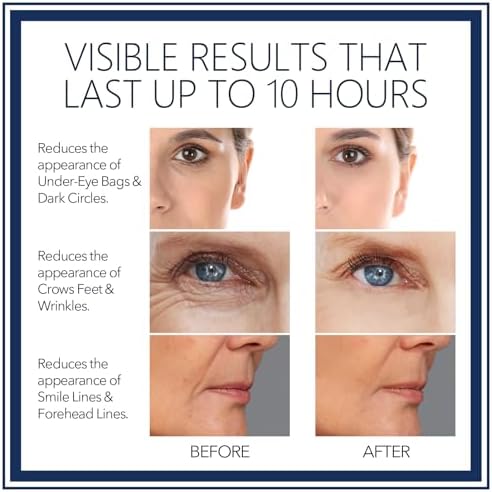 Fzbyylsrg eye serum tube with cap removed