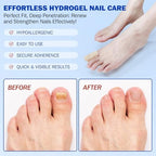 Authentic USA imported Elaimei nail treatment patches for men and women