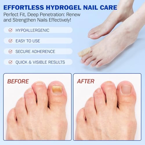 Authentic USA imported Elaimei nail treatment patches for men and women