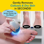 PediVac foot file with built-in vacuum sucking up skin shavings.