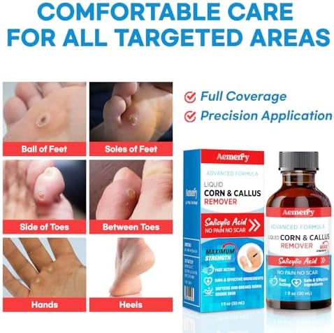 Aemerry extra strength salicylic acid corn and callus liquid remover targeted application guide.