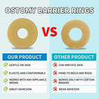 Moldable ostomy ring being shaped to fit personal stoma contours securely