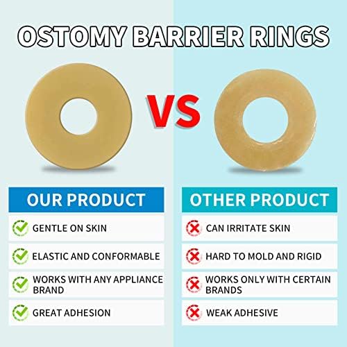 Moldable ostomy ring being shaped to fit personal stoma contours securely