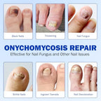Overnight hydrogel nail patches for discolored and brittle nail treatment.