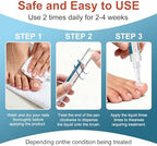 Before and after illustration of nail restoration using ERWCNMIE repair pens.