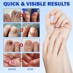 Before and after visualization of nail strengthening and discoloration improvement.