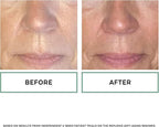 Replenix Retinol 5X Regenerate Dry Serum - Anti-Ageing Night Serum for Mature Skin, 30ml