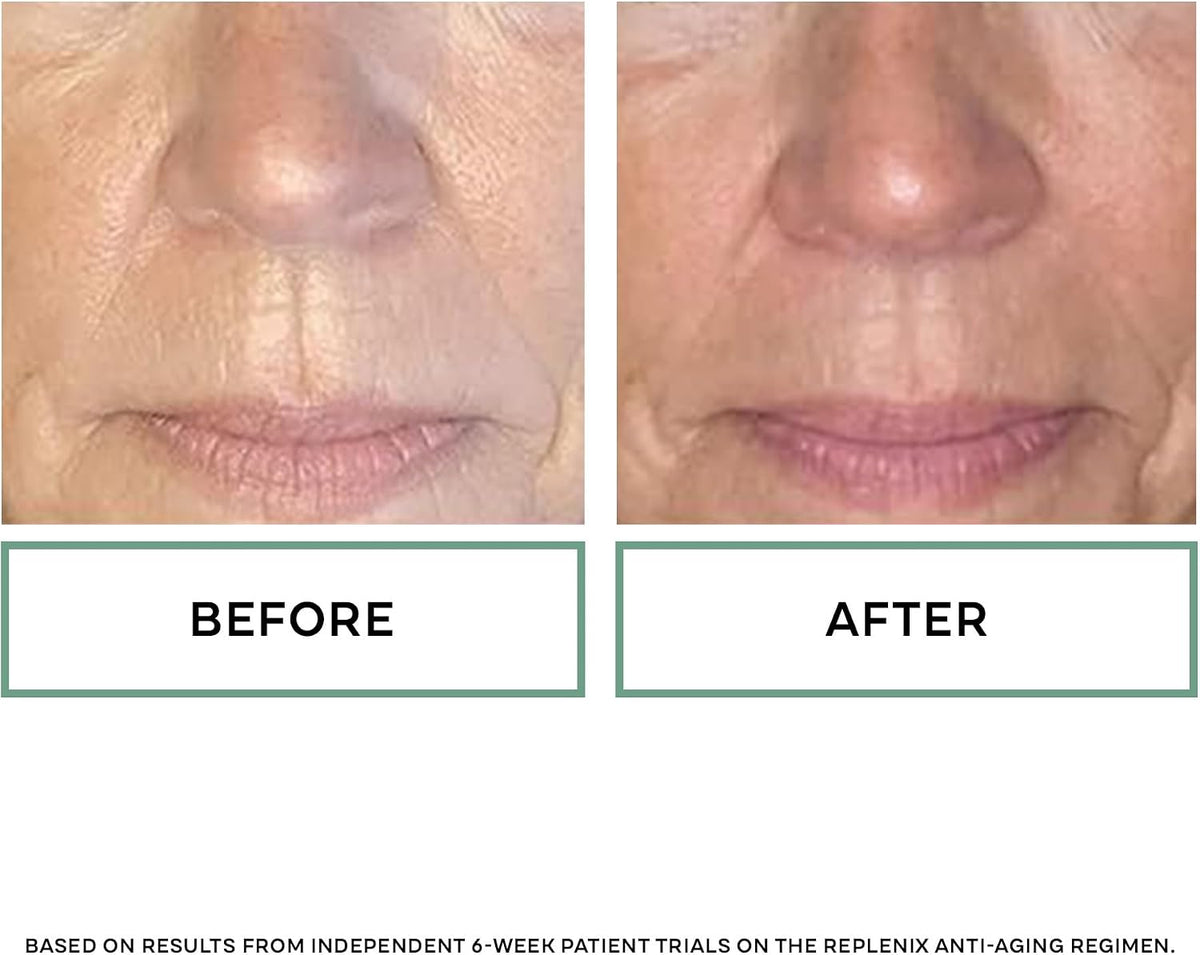 Replenix Retinol 5X Regenerate Dry Serum - Anti-Ageing Night Serum for Mature Skin, 30ml