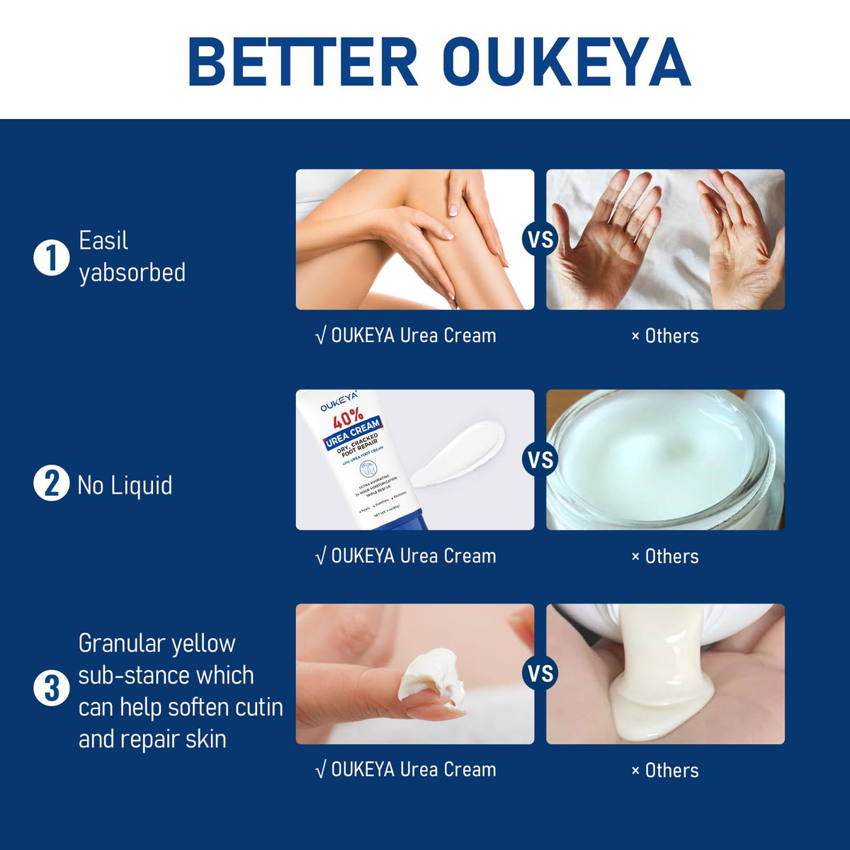 OUKEYA intensive urea cream three ounce packaging highlighting ingredients for calluses