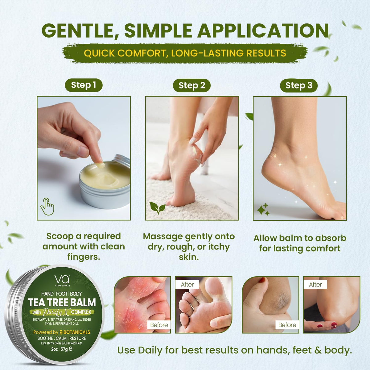 Authentic Vital Affair Tea Tree Oil Balm for soothing rashes, athlete's foot, and jock itch.