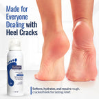 Close up of Footlogix mousse texture for non-greasy foot application