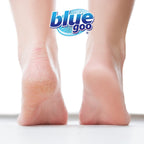 Blue Goo non petroleum skin protectant balm with pure emu oil for callus and corn relief