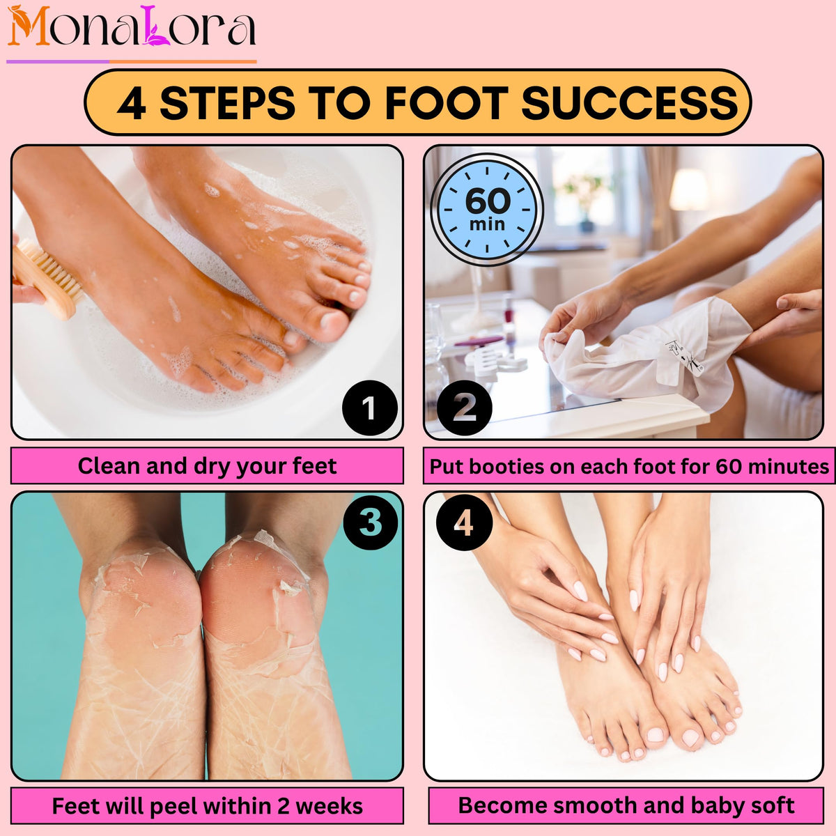 Before and after results of a foot peeling treatment for dry cracked heels
