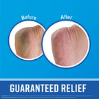 Authentic imported O'Keeffe's skincare set for repairing severely dry skin on hands and feet.