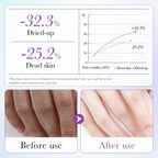 Side view of Anpode hand mask 5 pairs pack