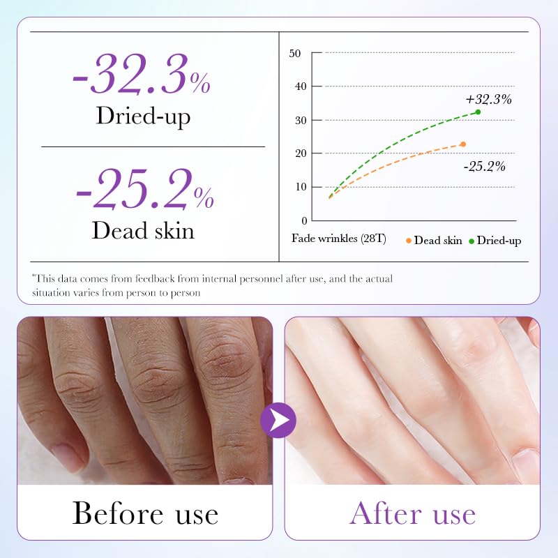 Side view of Anpode hand mask 5 pairs pack