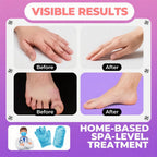 Person wearing Style Keepers moisturizing gel hand gloves