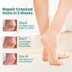 Welnove gel heel socks showing aloe vera infused lining detail