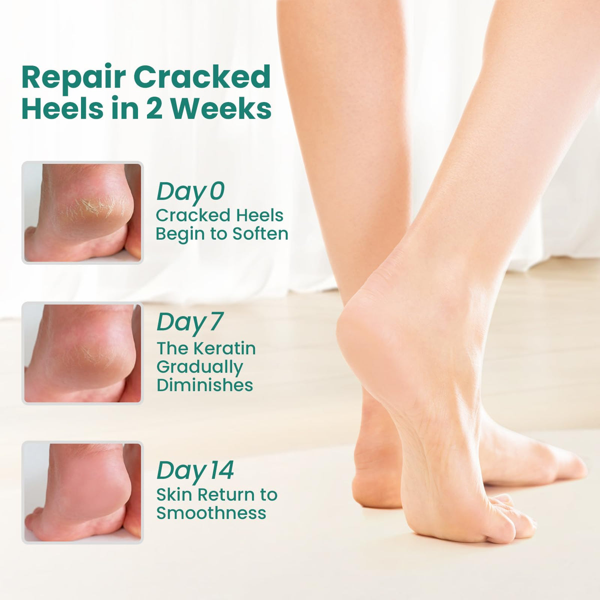 Welnove gel heel socks showing aloe vera infused lining detail