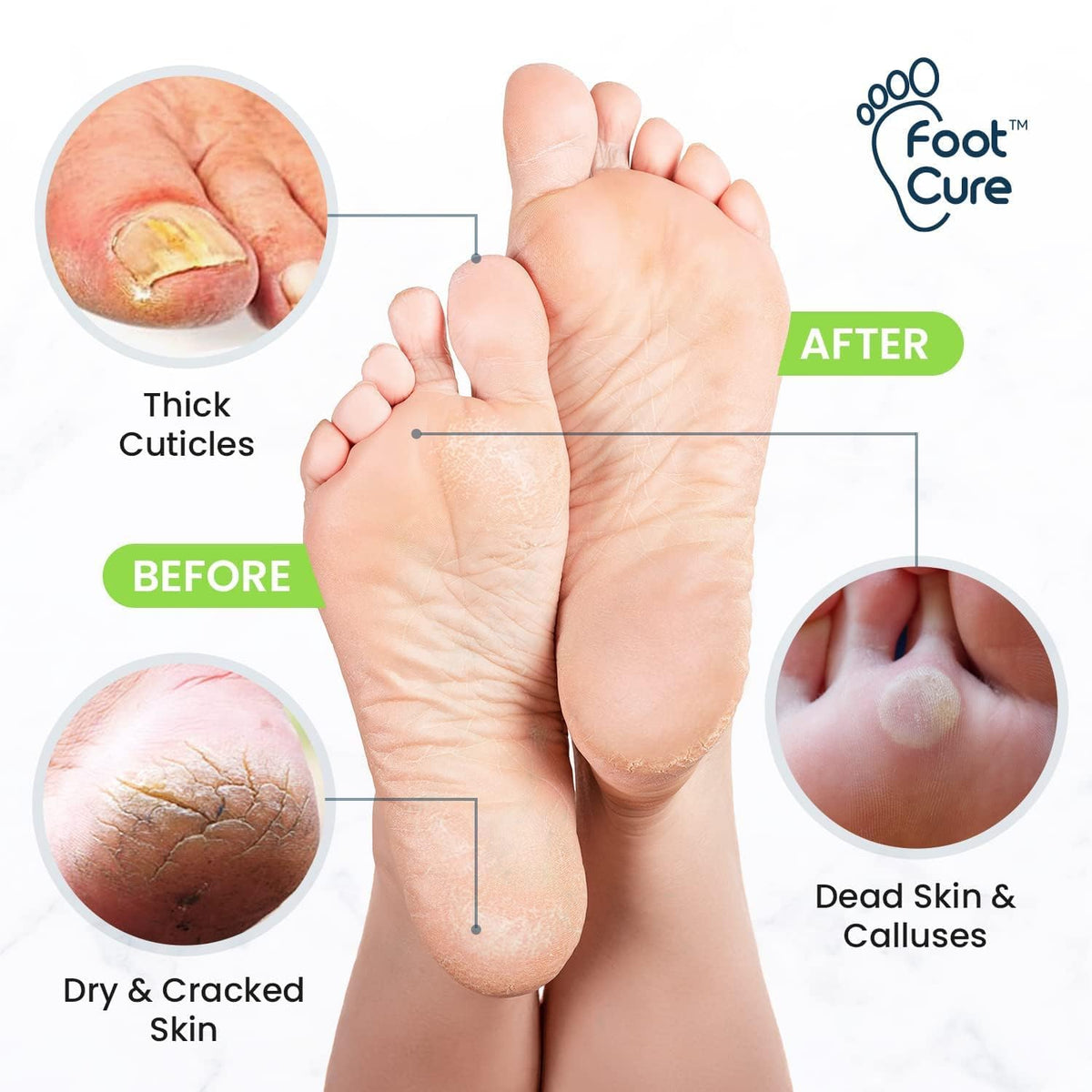 Detailed close up of Foot Cure foot file texture