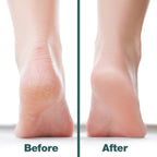 Probelle multidirectional foot care tool showing the full ten inch compact travel profile.