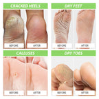 Foot Cure foot soak basin used for home pedicure spa treatment