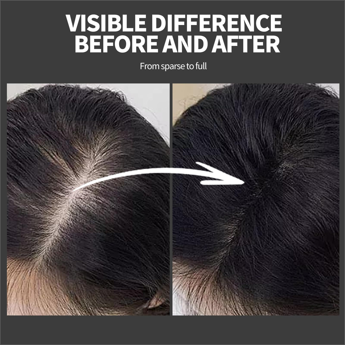 Instructional view demonstrating how to pat the cotton powder onto thinning hair areas